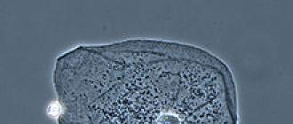 Методы микроскопии (люминесцентная, темнопольная, фазово-контрастная, электронная) Фазово контрастная микроскопия использует при изучении